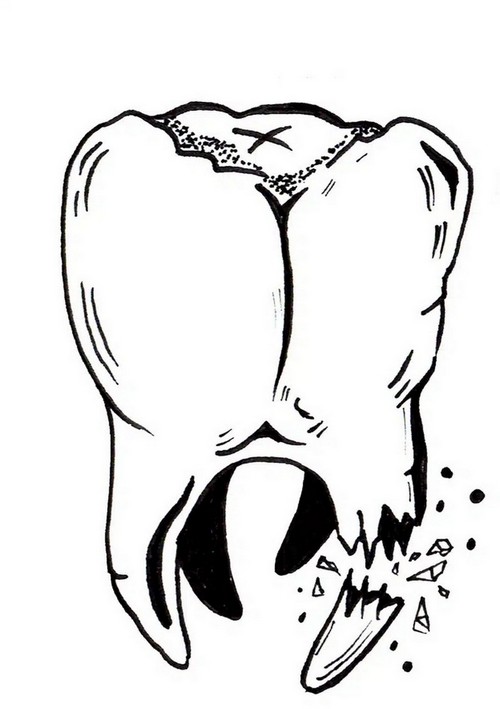 illustration dent